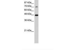 Image no. 2 for anti-Splicing Factor 3b, Subunit 4, 49kDa (SF3B4) (N-Term) antibody (ABIN202492) (SF3B4 anticorps  (N-Term))