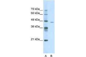 WB Suggested Anti-ACCN4 Antibody Titration:  0. (ACCN4 anticorps  (N-Term))