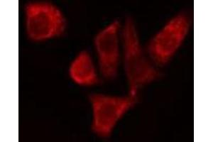 ABIN6274956 staining Hela cells by IF/ICC.