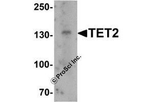 Western Blotting (WB) image for anti-Tet Methylcytosine Dioxygenase 2 (TET2) (N-Term) antibody (ABIN1031611)