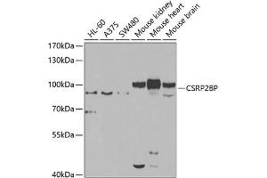 Western blot analysis of extracts of various cell lines, using CSRP2BP antibody (ABIN6127664, ABIN6139138, ABIN6139139 and ABIN6223242) at 1:1000 dilution. (CSRP2BP anticorps  (AA 523-782))