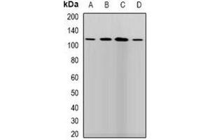 Western blot analysis of LLH expression in SKOV3 (A), HepG2 (B), mouse brain (C), mouse liver (D) whole cell lysates. (PLOD1 anticorps)