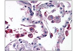 Human Lung: Formalin-Fixed, Paraffin-Embedded (FFPE) (TRIM7 anticorps  (C-Term))