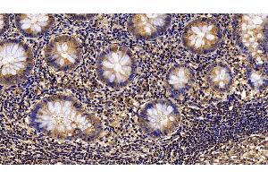 Detection of IL4R in Human Appendix Tissue using Polyclonal Antibody to Interleukin 4 Receptor (IL4R) (IL4 Receptor anticorps  (AA 26-232))