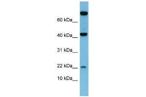 WB Suggested Anti-LEP Antibody Titration:  0. (Leptin anticorps  (N-Term))
