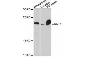 Western blot analysis of extracts of various cell lines, using RAB25 antibody (ABIN6290827) at 1:3000 dilution. (RAB25 anticorps)