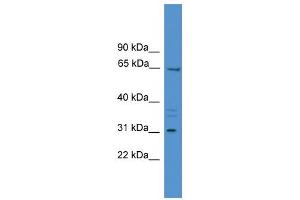 WB Suggested Anti-MEPE Antibody Titration:  0. (MEPE anticorps  (Middle Region))