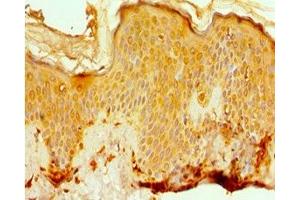 Immunohistochemistry of paraffin-embedded human skin tissue using ABIN7142077 at dilution of 1:100