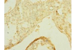 Immunohistochemistry of paraffin-embedded human testis tissue using ABIN7170303 at dilution of 1:100 (SLCO2B1 anticorps  (AA 130-210))
