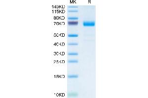 Mouse IL-20RA Protein on Tris-Bis PAGE under reduced condition.