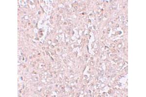 Immunohistochemical staining of human spleen cells with SLC39A13 polyclonal antibody  at 2. (SLC39A13 anticorps  (N-Term))