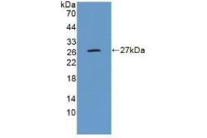 Western blot analysis of recombinant Human GluAP. (ENPEP anticorps  (AA 718-948))