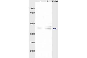 Lane 1: mouse embryo lysates Lane 2: mouse brain lysates probed with Anti TNFAIP5/Pentraxin 3 Polyclonal Antibody, Unconjugated (ABIN714686) at 1:200 in 4 °C. (PTX3 anticorps  (AA 151-250))