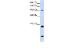 Image no. 1 for anti-Ring Finger Protein 20 (RNF20) (AA 576-625) antibody (ABIN6738066)