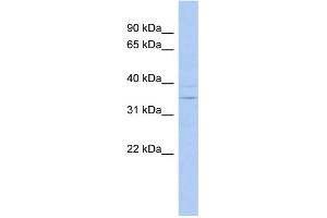 WB Suggested Anti-ASPDH Antibody Titration: 0. (ASPDH anticorps  (N-Term))