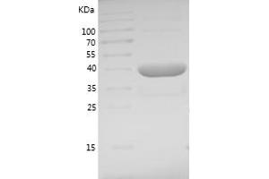 Western Blotting (WB) image for Ubiquitin-Conjugating Enzyme E2N (UBE2N) (AA 1-152) protein (GST tag) (ABIN7125624) (UBE2N Protein (AA 1-152) (GST tag))