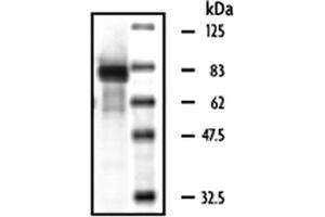 Western Blotting (WB) image for Macrophage Stimulating 1 (Hepatocyte Growth Factor-Like) (MST1) (Active) protein (ABIN2669400) (MST1 Protéine)