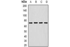 Western blot analysis of SDHA expression in HepG2 (A), MCF7 (B), mouse liver (C), mouse stomach (D) whole cell lysates. (SDHA anticorps)