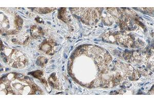 ABIN6277180 at 1/100 staining Human prostate tissue by IHC-P.