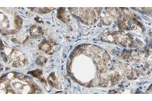 ABIN6277180 at 1/100 staining Human prostate tissue by IHC-P. (ABCC4 anticorps)
