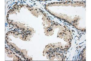 Immunohistochemical staining of paraffin-embedded pancreas tissue using anti-ERCC1 mouse monoclonal antibody. (ERCC1 anticorps)
