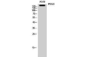 Western Blotting (WB) image for anti-Paternally Expressed 3 (PEG3) (Internal Region) antibody (ABIN3186389) (PEG3 anticorps  (Internal Region))