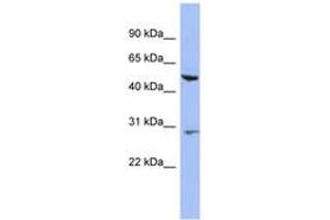 Image no. 1 for anti-Keratin 75 (KRT75) (N-Term) antibody (ABIN6744317) (Keratin 75 anticorps  (N-Term))