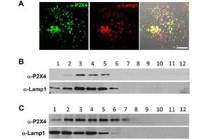 Expression of P2X4 receptor in lysosomes.