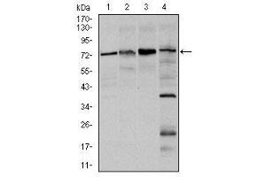 Image no. 4 for anti-Forkhead Box O1 (FOXO1) antibody (ABIN1498297)