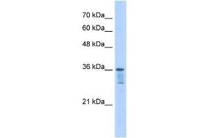 LZTFL1 antibody used at 2.