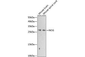 Western blot analysis of extracts of various cell lines, using NOG antibody (ABIN6128385, ABIN6144701, ABIN6144702 and ABIN6224318) at 1:1000 dilution. (NOG anticorps  (AA 28-232))