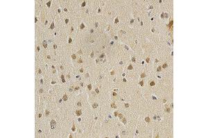 Immunohistochemistry of paraffin-embedded mouse brain using HDAC6 antibody at dilution of 1:200 (x400 lens)