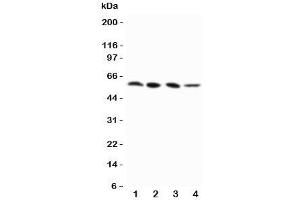 Western blot testing of RIP3 antibody and Lane 1:  PANC;  2: SW620;  3: SKOV-3;  4: M231 cell lysate