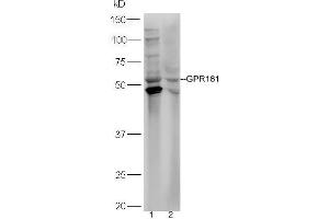 Lane 1: HepG2 lysates Lane 2: HL-60  lysates probed with Rabbit Anti-GPR161 Polyclonal Antibody, Unconjugated (ABIN2174751) at 1:300 overnight at 4 °C. (GPR161 anticorps  (AA 121-220))