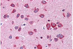 Human Brain, Cortex: Formalin-Fixed, Paraffin-Embedded (FFPE)