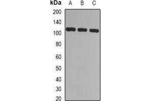 Western blot analysis of CBLB expression in Jurkat (A), 293T (B), mouse spleen (C) whole cell lysates. (Cbl Proto-Oncogene B, E3 Ubiquitin Protein Ligase (CBLB) anticorps)