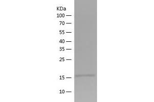 Western Blotting (WB) image for Myosin Regulatory Light Polypeptide 9 (MYL9) (AA 1-118) protein (His tag) (ABIN7124067)