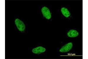 Immunofluorescence of monoclonal antibody to GBX2 on HeLa cell. (GBX2 anticorps  (AA 114-182))