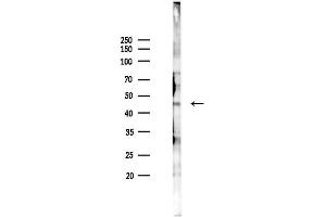Western blot analysis of lysates from K562 cells(heat-shock 45 min treatment), using Phospho-CCR5 (Ser336) Antibody at 1/1000 dilution.