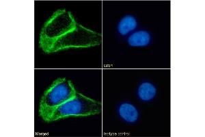 Immunofluorescence staining of fixed A431 cells with anti-Tetraspanin 1 antibody 4/12. (Recombinant TSPAN1 anticorps  (Extracellular Domain))