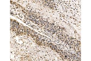 IHC analysis of SSB using anti-SSB antibody (ABIN7602125). (SSB anticorps  (AA 6-283))
