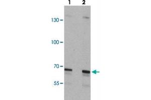 Western blot analysis of SLC27A6 in A-20 cell lysate with SLC27A6 polyclonal antibody  at (lane 1) 1 and (lane 2) 2 ug/mL. (SLC27A6 anticorps  (N-Term))