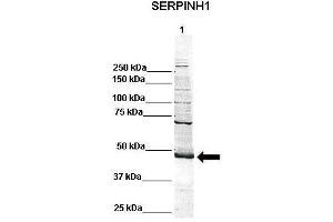 WB Suggested Anti-SERPINH1 Antibody  Positive Control: Lane 1:841 µg mouse brain extract Primary Antibody Dilution: 1:000Secondary Antibody: IRDye 800 CW goat anti-rabbit from Li-COR BioscienceSecondry  Antibody Dilution: 1:00,000Submitted by: Dr.
