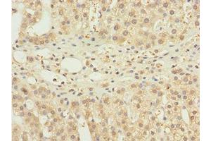 Immunohistochemistry of paraffin-embedded human adrenal gland tissue using ABIN7161518 at dilution of 1:100 (NBR1 anticorps  (AA 1-280))