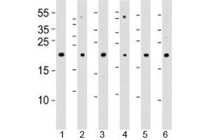Western blot analysis of lysate from 1) 293T, 2) HeLa, 3) Jurkat, 4) Y79 cell line , 5) mouse spleen and 6) rat kidney tissue lysate using DHFR antibody at 1:1000. (Dihydrofolate Reductase anticorps  (AA 1-50))
