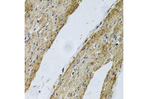 Immunohistochemistry of paraffin-embedded human smooth muscle using VCL Antibody. (Vinculin anticorps  (AA 767-1066))