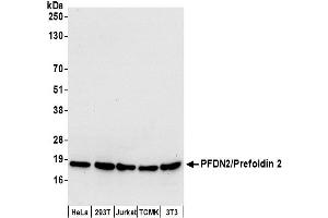 Western Blotting (WB) image for anti-Prefoldin Subunit 2 (PFDN2) (AA 104-154) antibody (ABIN7450553)