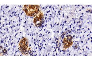 Detection of CK7 in Rat Parotid Gland Tissue using Polyclonal Antibody to Cytokeratin 7 (CK7) (Cytokeratin 7 anticorps  (AA 91-394))