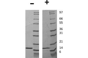 SDS-PAGE of Human Granulocyte Colony Stimulating Factor Recombinant Protein SDS-PAGE of Human Granulocyte Colony Stimulating Factor Recombinant Protein.