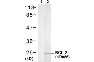 Image no. 1 for anti-B-Cell CLL/lymphoma 2 (BCL2) (pThr56) antibody (ABIN273336) (Bcl-2 anticorps  (pThr56))